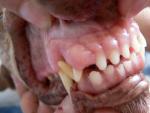 <p>Zduření dásně u pravého horního řezáku. Může být nádorového i nenádorového původu, pro zjištění charakteru útvaru a rozhodnutí o jeho správné terapii je nutné provést histopatologické vyšetření.</p>