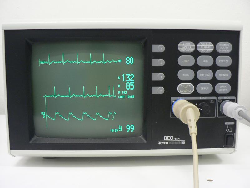 EKG a oxymetrie